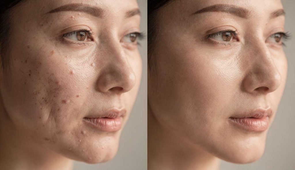 Kobido : avant-Après et Bienfaits du Massage Facial Japonais