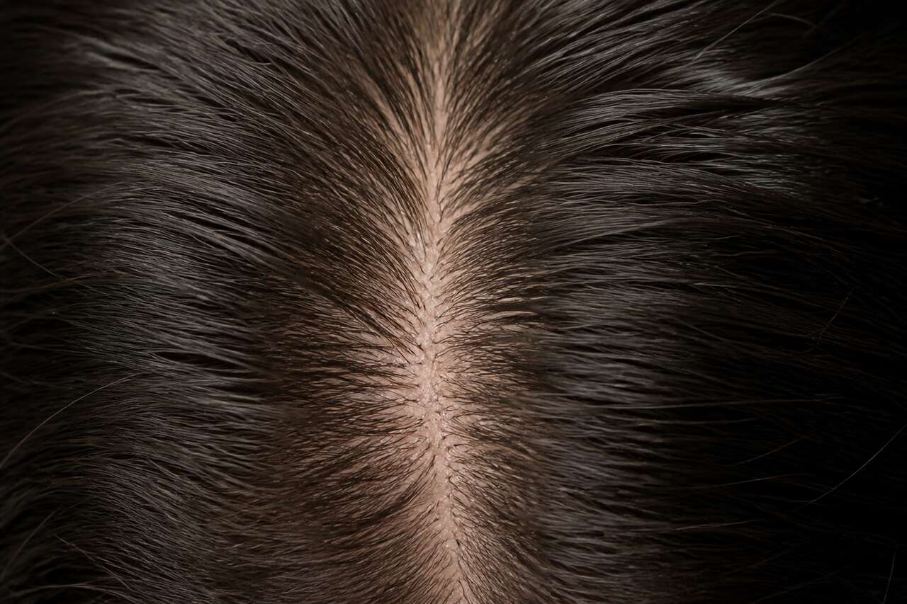 Le cuir chevelu, un écosystème qui conditionne tout Le cuir chevelu, un écosystème qui conditionne tout
